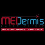 Medermis Laser Clinic - Tattoo Removal in San Antonio