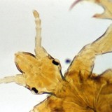 The Texas Lice Squad - Medical Centers in Houston