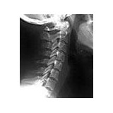 Capuli Chiropractic Healthcare - Chiropractors in Arlington