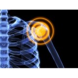 Metroplex Therapeutic Massage - Massage Therapy in Fort Worth
