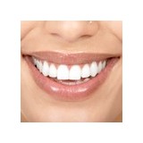 Bliss Dental Practice Ltd - Dentists in London