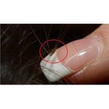 Itch No More - Specialized Head Lice Treatment Service - Other in Epping