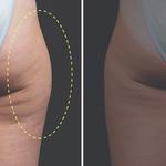 Gambhir Cosmetic Medicine - photo 4