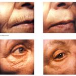 Gambhir Cosmetic Medicine - photo 5