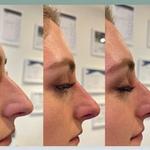 Dr Lucy Facial Aesthetics - photo 2