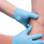 Apex Endovascular - photo 5