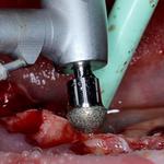 Universal Shapers - photo 1