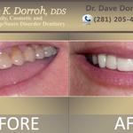 Dr. Dave Dorroh, DDS - photo 4