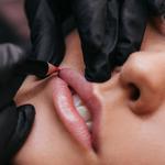 Skn Plus Aesthetic Clinic - photo 5