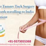 Liposuction Surgery in India - photo 3