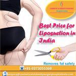 Liposuction Surgery in India - photo 6