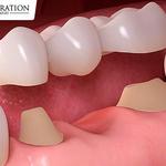 Restoration Smiles Of Tomball - photo 4