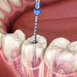 Super Smile Dental - photo 3