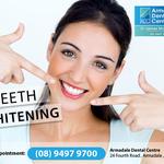 Dental Implants Armadale WA 6112 - All on 4 Dental Implants - Armadale Dental Centre - photo 2