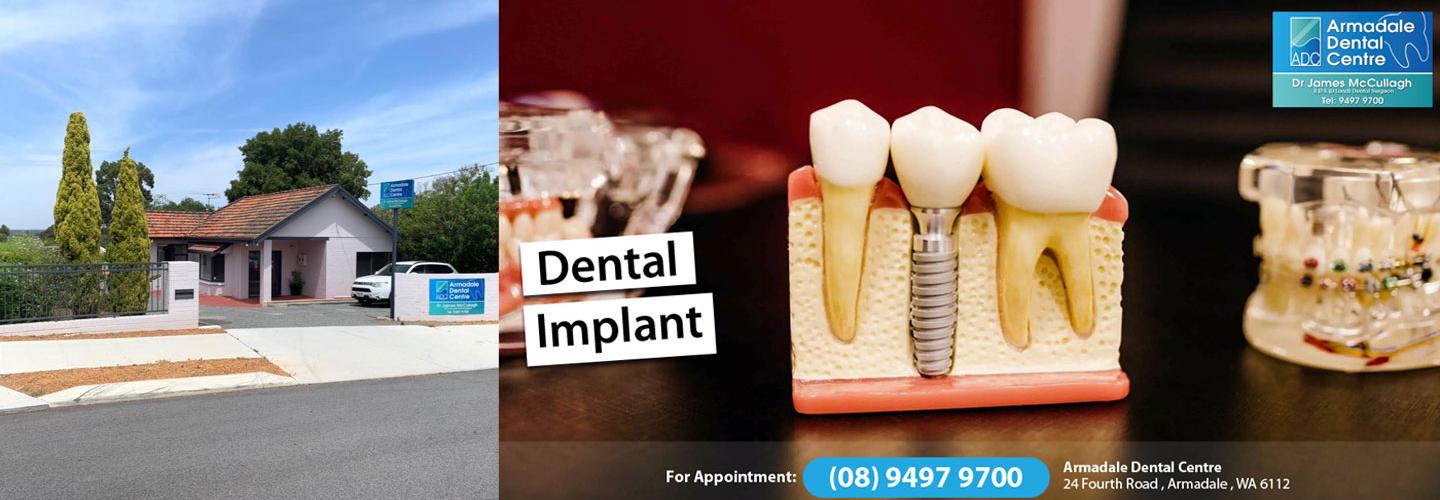 Dental Implants Armadale WA 6112 - All on 4 Dental Implants - Armadale Dental Centre cover photo