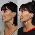 The Laser Lounge Spa Plymouth - photo 1