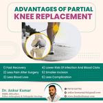 Dr. Ankur Kumar | Best Orthopedic Surgeon - photo 8