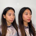 Contour Clinique Med Spa - photo 4