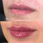 Contour Clinique Med Spa - photo 8