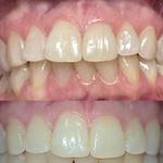 Armstrong Dental Care - photo 2