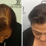 Scalp Ink Design - Scalp Micropigmentation - photo 4