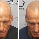 Scalp Ink Design - Scalp Micropigmentation - photo 6