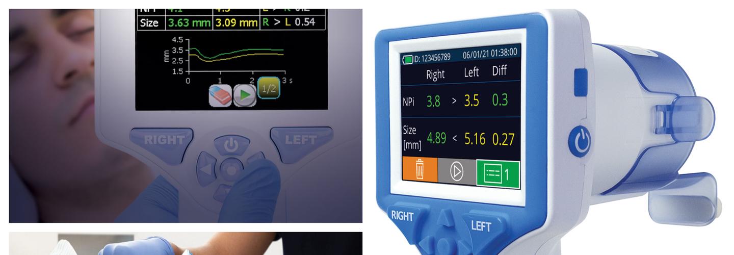 NeurOptics, Inc cover photo