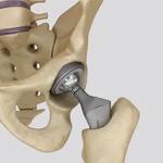 Hip and Knee Orthopaedics - photo 5