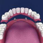 Keele Crosstown Dental - photo 6