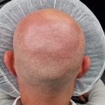 Scalp Styles UK - photo 1