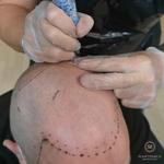 Scalp Styles UK - photo 5