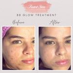 Tinted Skin - photo 1