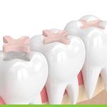 Serenity Smiles Dental - photo 4