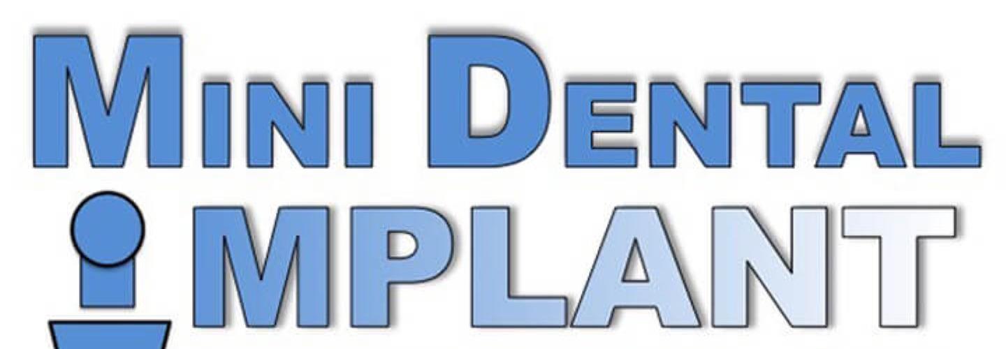 Dental-Implant-Smilesd cover photo