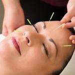 Tao Acupuncture - photo 3