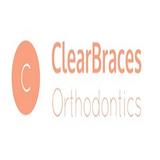 Clear Braces Orthodontics - Dental Technicians/Dentures/Implants in Sydney