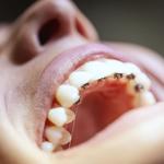 Clear Braces Orthodontics - photo 1