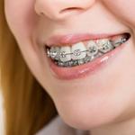 Clear Braces Orthodontics - photo 2
