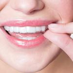 Clear Braces Orthodontics - photo 4