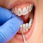 Clear Braces Orthodontics - photo 5