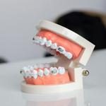 Clear Braces Orthodontics - photo 6