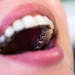 Clear Braces Orthodontics - photo 7