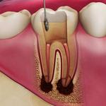 Hillsborough Prime Dental - photo 1