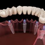 Hillsborough Prime Dental - photo 4