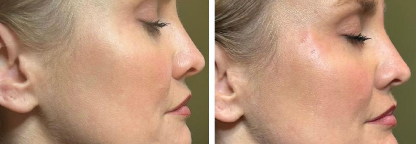 Elite Medical Spa of Parrish cover photo