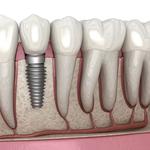 Crown Point Dental - photo 3