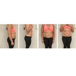 UNIQ LASER - WATERTOWN - photo 2