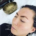 Ombright Wellness Acupuncture -Mobile Acupuncture Therapy - photo 3