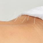 White Raven Acupuncture - photo 6