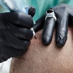 Skalp ink micropigmentation - photo 2